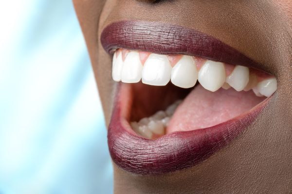 Who Is A Good Candidate For Full Mouth Reconstruction?